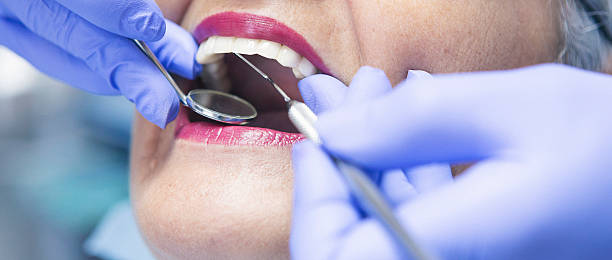 Best Emergency Root Canal Treatment in Spanish Fort, AL